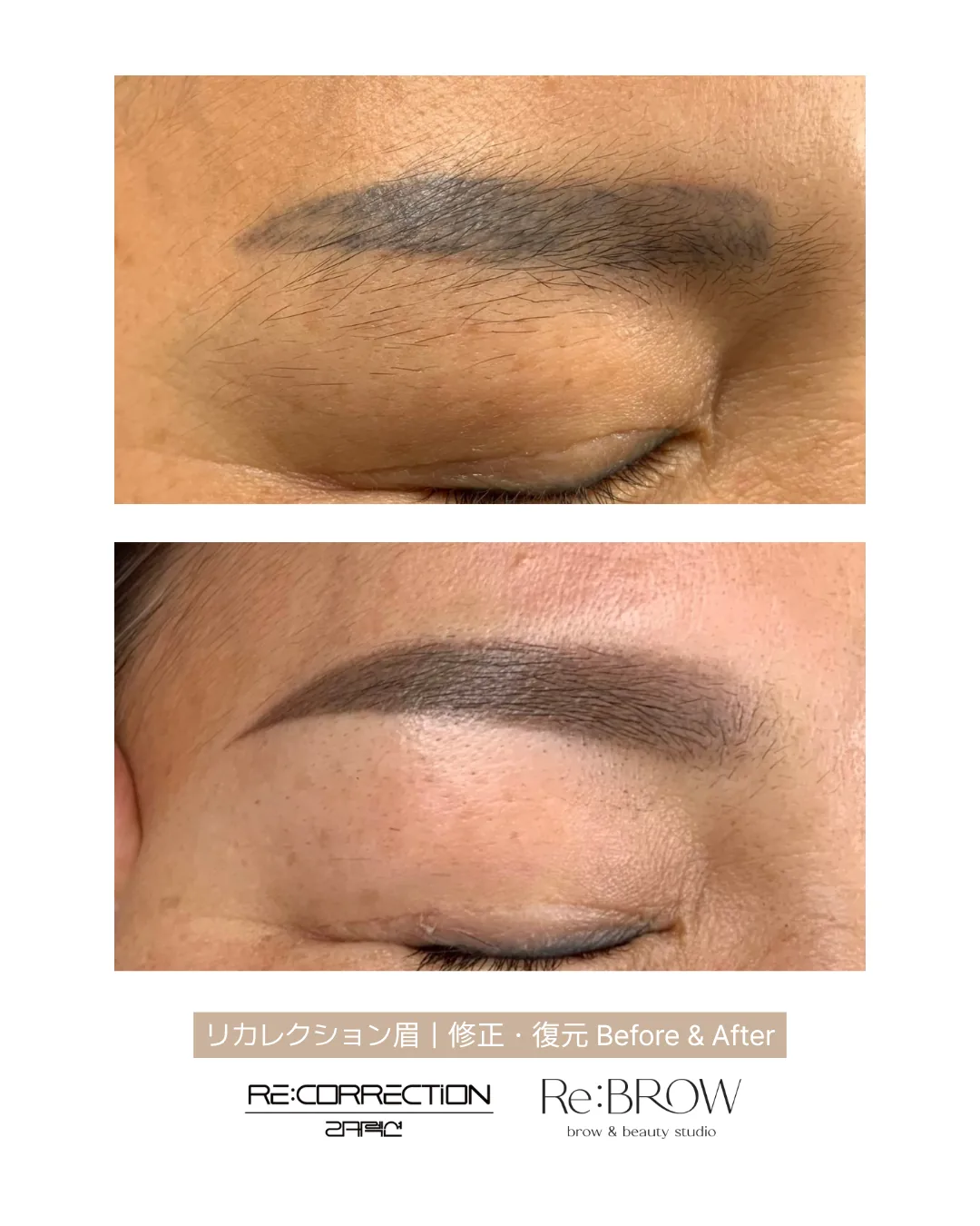 번진 눈썹 반영구 리커렉션 결과 · Re:BROW 리브로우