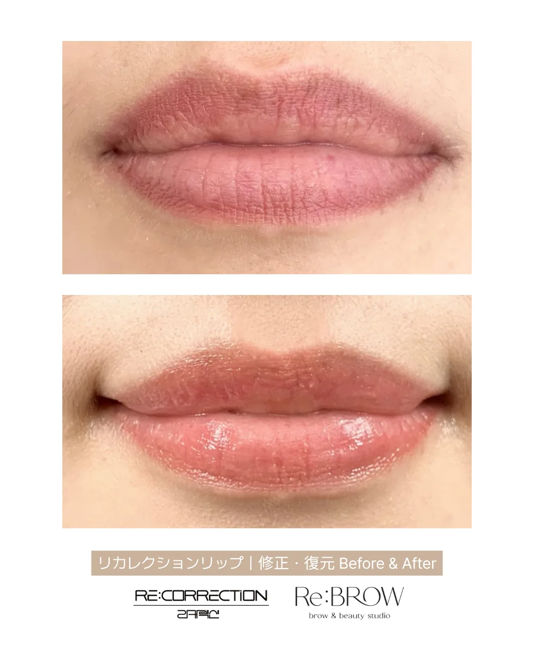 입술 리커렉션 비포&애프터 · Re:BROW 리브로우